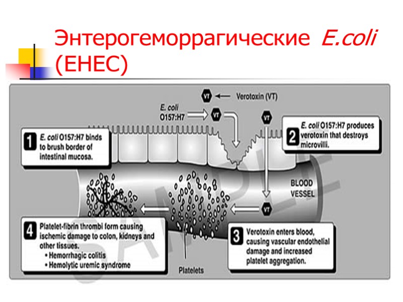 Энтерогеморрагические E.coli (EHEC)